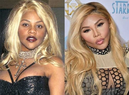 A picture of Lil' Kim before (left) and after (right).